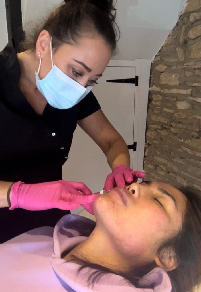 Lip Filler Treatment